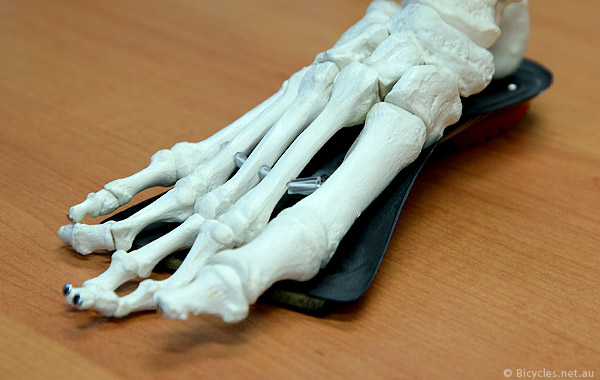 Forefoot Varus Arch Support